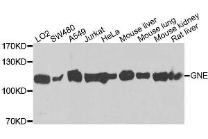 Western blot analysis of extracts of various cell lines, using GNE antibody (ABIN5996449) at 1/1000 dilution. (GNE Antikörper)