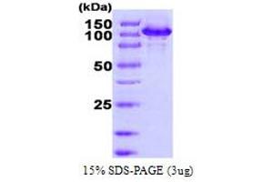 SDS-PAGE (SDS) image for Heat Shock 105kDa/110kDa Protein 1 (HSPH1) (AA 1-858) protein (His tag) (ABIN667067)