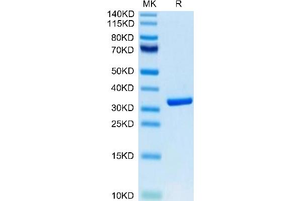 HMGB1 Protein (AA 1-215) (His tag,Biotin)