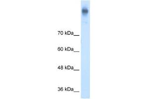 Western Blot showing SLC12A2 antibody used at a concentration of 1-2 ug/ml to detect its target protein. (SLC12A2 Antikörper)