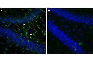 Expression of GPR43/FFAR2 in rat hippocampus. (FFAR2 Antikörper  (C-Term, Intracellular))
