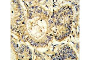 Immunohistochemistry (IHC) image for anti-Suppressor of Cytokine Signaling 1 (SOCS1) (AA 35-66) antibody (ABIN3029042)