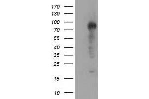 HEK293T cells were transfected with the pCMV6-ENTRY control (Left lane) or pCMV6-ENTRY TACC3 (Right lane) cDNA for 48 hrs and lysed. (TACC3 Antikörper)