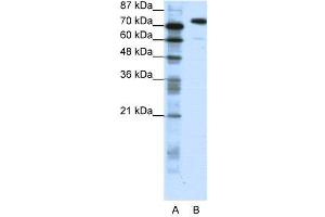 WB Suggested Anti-SATB1  Antibody Titration: 1. (SATB1 Antikörper  (C-Term))