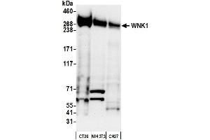 Western Blotting (WB) image for anti-WNK Lysine Deficient Protein Kinase 1 (WNK1) (AA 2100-2150) antibody (ABIN7450908)
