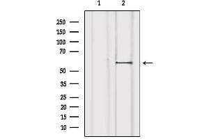 Western blot analysis of extracts from 293, using Estrogen Receptor-beta Antibody. (ESR2 Antikörper)