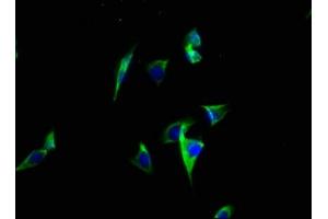 Immunofluorescence staining of A549 cells with ABIN7146408 at 1:100, counter-stained with DAPI. (ATP2C2 Antikörper  (AA 621-702))