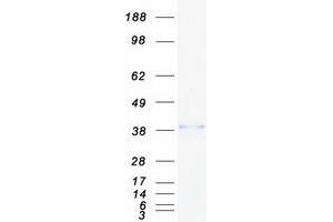 Western Blotting (WB) image for Alcohol Dehydrogenase 5 (Class III), chi Polypeptide (ADH5) protein (Myc-DYKDDDDK Tag) (ABIN2714531)