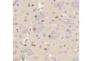 Immunohistochemistry analysis of paraffin-embedded rat brain using VMAT2 (ABIN7075655) at dilution of 1: 1600 (SLC18A2 Antikörper)