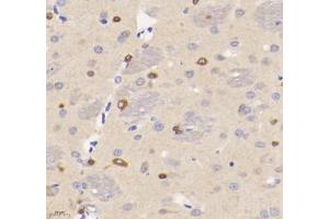 Immunohistochemistry analysis of paraffin-embedded rat brain using VMAT2 (ABIN7075655) at dilution of 1: 1600 (SLC18A2 Antikörper)