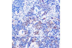 Immunohistochemistry of paraffin-embedded mouse spleen using CD24 Rabbit pAb (ABIN1512696, ABIN3023213, ABIN3023214 and ABIN6219443) at dilution of 1:100 (40x lens).