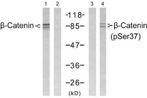 Western blot analysis of extract from SW 626 cells, using β-Catenin (Ab-37) antibody (E021212, Lane 1 and 2) and β-Catenin (phospho-Ser37) antibody (E011219, Lane 3 and 4). (beta Catenin Antikörper  (pSer37))
