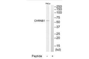 Western blot analysis of extracts from HeLa cells, using CHRNB1 antibody. (CHRNB1 Antikörper  (N-Term))