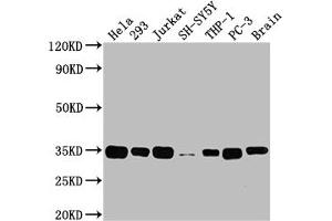 Western Blot Positive WB detected in: Hela whole cell lysate, 293 whole cell lysate, Jurkat whole cell lysate, SH-SY5Y whole cell lysate, THP-1 whole cell lysate, PC-3 whole cell lysate, Rat brain tissue All lanes: ATF5 antibody at 1:2000 Secondary Goat polyclonal to rabbit IgG at 1/50000 dilution Predicted band size: 31 kDa Observed band size: 35 kDa (Rekombinanter ATF5 Antikörper)