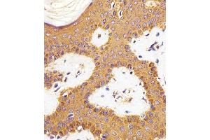 Immunohistochemical analysis of paraffin-embedded H. (RAC1 Antikörper)