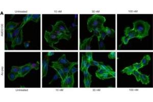 HMGB1 CXCL12 : the first fuzzy chemokines heterocomplex reported so far (HMGB1 Protein (Fully reduced))