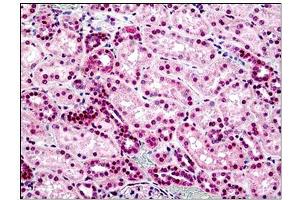 Human Kidney: Formalin-Fixed, Paraffin-Embedded (FFPE) (STEAP2 Antikörper  (AA 455-467))