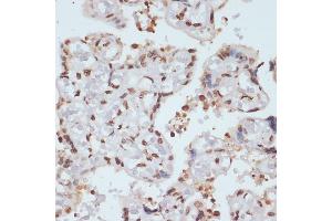 Immunohistochemistry of paraffin-embedded human placenta using Phospho-Chk1-S280 antibody (ABIN3019445, ABIN3019446, ABIN3019447 and ABIN6225372) at dilution of 1:100 (40x lens). (CHEK1 Antikörper  (pSer280))