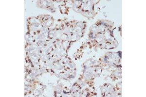Immunohistochemistry of paraffin-embedded human placenta using Phospho-Chk1-S280 antibody (ABIN3019445, ABIN3019446, ABIN3019447 and ABIN6225372) at dilution of 1:100 (40x lens).
