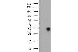 Western Blotting (WB) image for anti-Aminoacylase 3 (ACY3) antibody (ABIN1496466) (Aminoacylase 3 Antikörper)