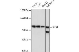 Western blot analysis of extracts of various cell lines, using SNX1 Rabbit mAb (ABIN7270502) at 1:1000 dilution. (Sorting Nexin 1 Antikörper)