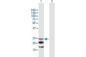 Western Blot analysis of NAAA expression in transfected 293T cell line by NAAA MaxPab polyclonal antibody. (NAAA Antikörper  (AA 1-199))