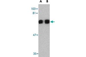 Western blot analysis of PRDM1 in A-549 cell lysate with PRDM1 polyclonal antibody  at (A) 0.