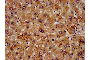 IHC image of ABIN7152853 diluted at 1:500 and staining in paraffin-embedded human liver tissue performed on a Leica BondTM system. (FGFRL1 Antikörper  (AA 403-470))