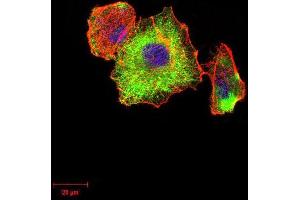 Immunocytochemistry (ICC) image for anti-Tubulin, beta 1 (TUBB1) (AA 33-166) antibody (ABIN5879491) (TUBB1 Antikörper  (AA 33-166))