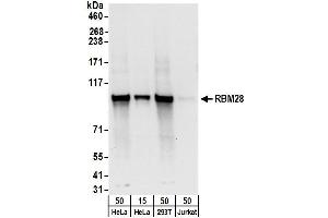 anti-RNA Binding Motif Protein 28 (RBM28) (AA 709-759) antibody