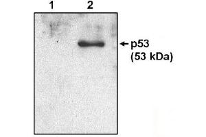 Western Blotting (WB) image for anti-Tumor Protein P53 (TP53) (AA 371-380) antibody (ABIN264449)