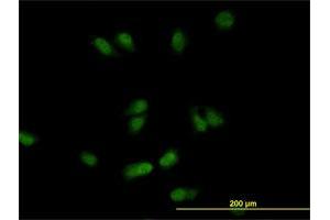 Immunofluorescence of monoclonal antibody to CSE1L on HeLa cell. (Exportin 2 Antikörper  (AA 872-971))