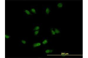 Immunofluorescence of monoclonal antibody to CSE1L on HeLa cell.