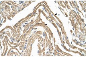 Human Muscle (CCBP2 Antikörper  (N-Term))