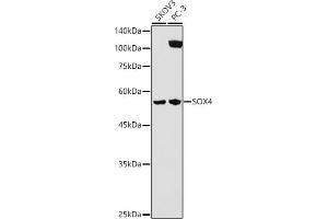 Western blot analysis of extracts of various cell lines, using SOX4 antibody (ABIN7270575) at 1:1000 dilution. (SOX4 Antikörper  (AA 1-100))