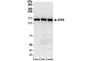 anti-Isoleucyl-tRNA Synthetase (IARS) (AA 1-50) antibody