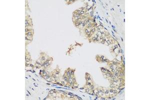 Immunohistochemistry of paraffin-embedded human prostate using RRM1 antibody at dilution of 1:200 (40x lens). (RRM1 Antikörper)
