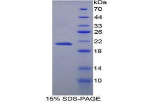 SDS-PAGE (SDS) image for Apolipoprotein B (APOB) protein (His tag) (ABIN1078865) (APOB Protein (His tag))