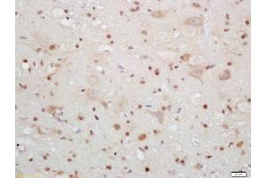 Formalin-fixed and paraffin embedded mouse brain labeled with Rabbit Anti-CIRBP Polyclonal Antibody, Unconjugated (ABIN872483) at 1:200 followed by conjugation to the secondary antibody and DAB staining (CIRBP Antikörper  (AA 61-172))