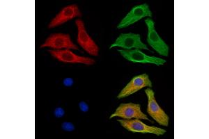 ABIN6256040 and ABIN6267417 staining H2O2 treated Hela cells by IF/ICC. (Vinculin Antikörper  (pTyr822))