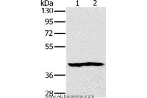 Western blot analysis of Mouse heart and kidney tissue, using NDUFA10 Polyclonal Antibody at dilution of 1:450 (NDUFA10 Antikörper)