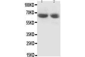 Anti-GAD65 antibody, Western blotting Lane 1: Rat Brain Tissue Lysate Lane 2: Rat Brain Tissue Lysate