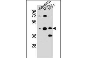 hCG_1645727 Antibody (C-term) (ABIN656073 and ABIN2845421) western blot analysis in MDA-M,ZR-75-1,MCF-7 cell line lysates (35 μg/lane).