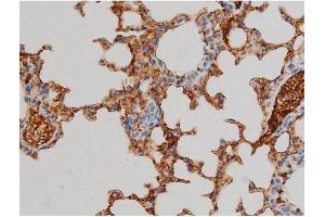 Immunohistochemistry (IHC) image for anti-Ezrin (EZR) (pTyr478) antibody (ABIN6255926)