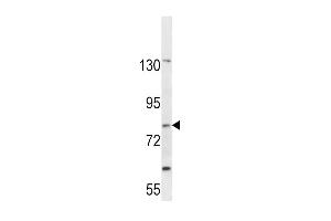 Western blot analysis in CEM cell line lysates (35ug/lane). (SLC15A1 Antikörper  (C-Term))