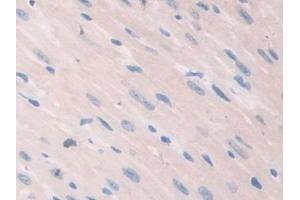 Immunohistochemistry (IHC) image for anti-Caspase Recruitment Domain Family, Member 9 (CARD9) (AA 274-530) antibody (ABIN7439921)