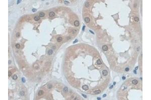 Immunohistochemistry (IHC) image for anti-Ezrin (EZR) (AA 1-295) antibody (ABIN7440074)