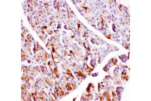 Anti- GPX1 antibody, IHC(P) IHC(P): Rat Pancreas Tissue (Glutathione Peroxidase 1 Antikörper  (Middle Region))