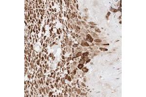 Immunohistochemical staining of human placenta with ATP9B polyclonal antibody  shows strong cytoplasmic positivity in decidual cells at 1:20-1:50 dilution. (ATP9B Antikörper)