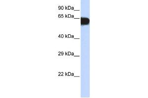 Western Blotting (WB) image for anti-T-Box 18 (TBX18) antibody (ABIN2458234) (T-Box 18 Antikörper)